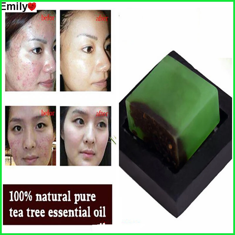 tea tree oil and acne reviews